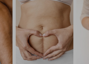 What Makes Scarease Special in Scar Care and Skincare Solutions